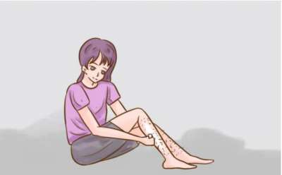 难道用薇婷脱毛膏会越脱越多吗？