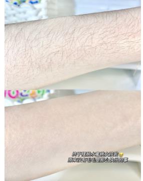 你知道薇婷脱毛膏使用方法吗