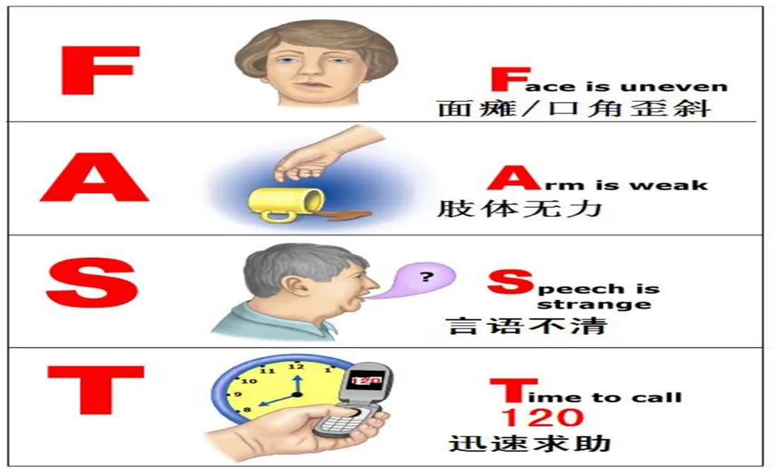 【世界卒中日】时间就是大脑，教你快速识别卒中
