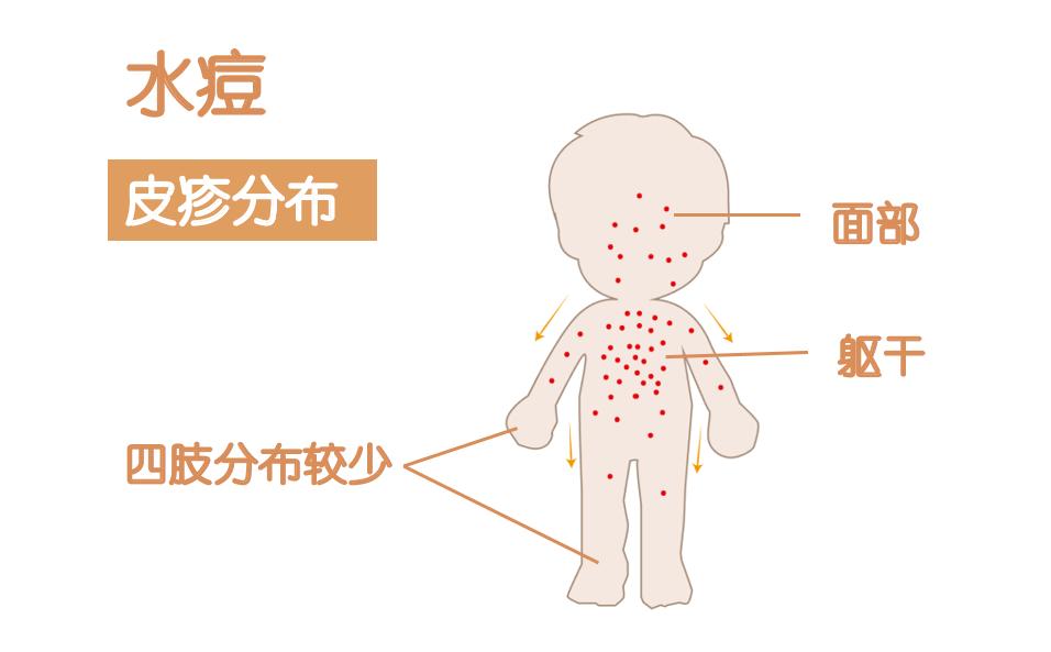 春季高发传染病都有哪些?怎样预防?