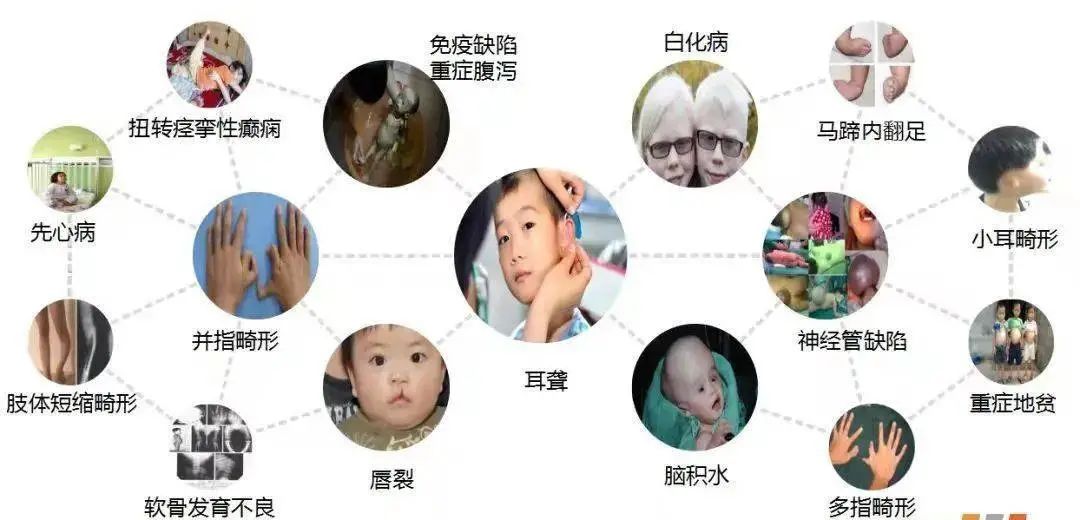 【国际罕见病日】为爱呐“罕”，让罕见 被看见!
