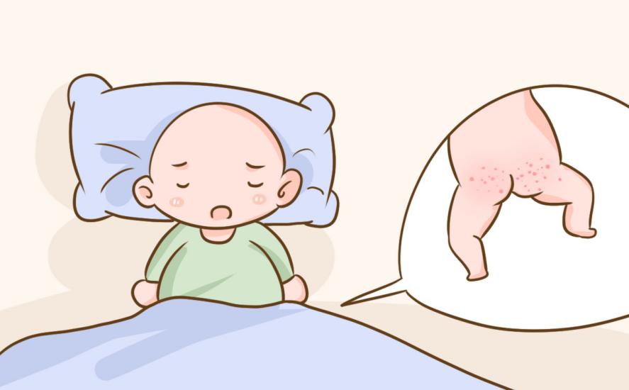 宝宝腹泻红屁屁，用京万红就能治