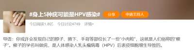 【注意】警惕这些疣，小心HPV感染