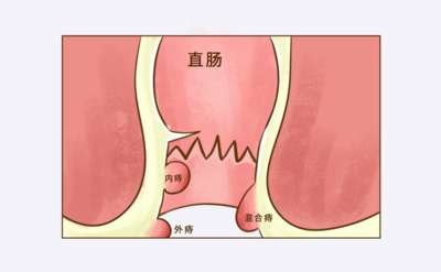外伤手术后抹京万红软膏会使伤口愈合快吗？