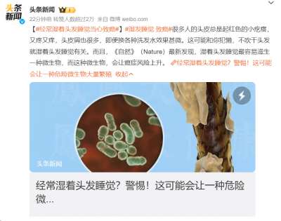 湿发睡觉会怎样?答案可不只有感冒……